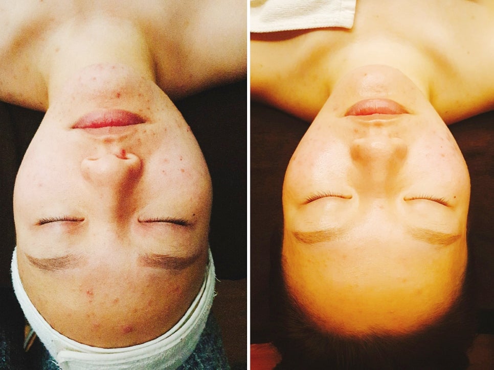 태후바디케어 이미지
