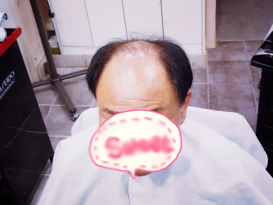 김호증모가발춘천체인점 이미지