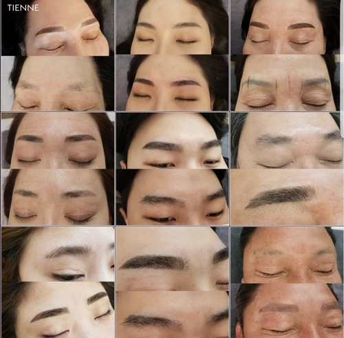 티엔느스킨뷰티 이미지