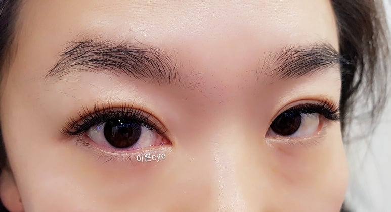 EYE이뻐 이미지