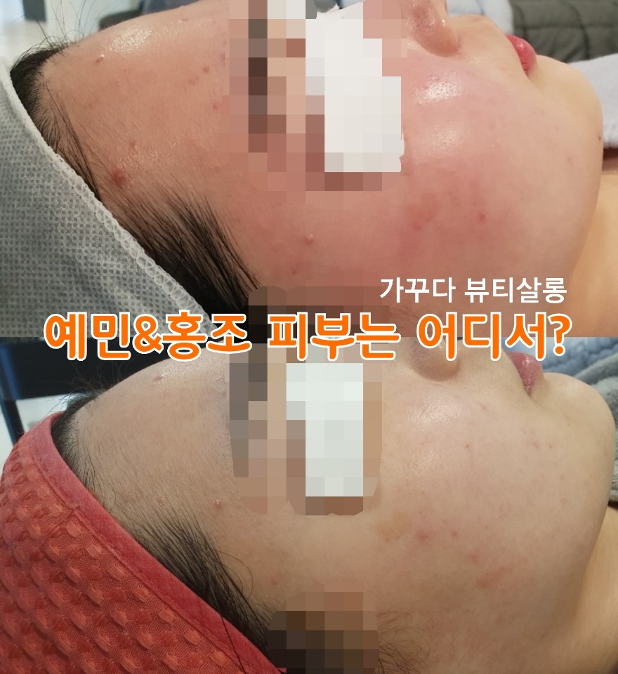 가꾸다뷰티 이미지