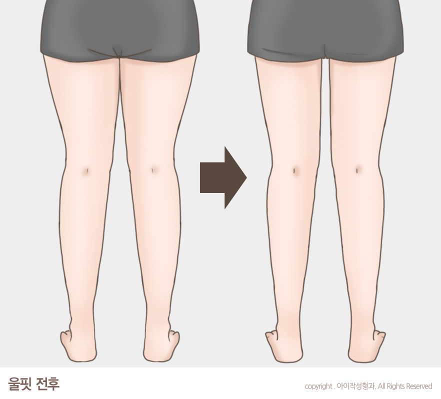 아이작성형외과의원 이미지