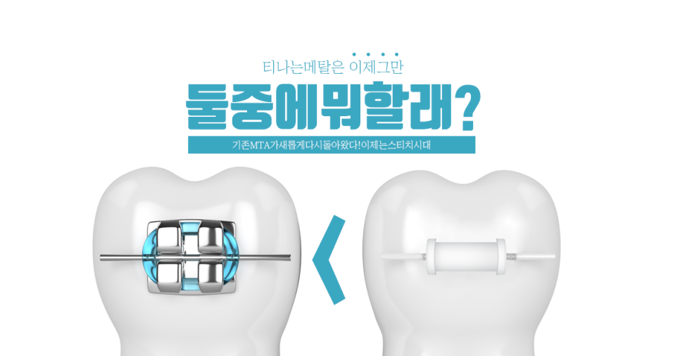스티치킹콩 이미지