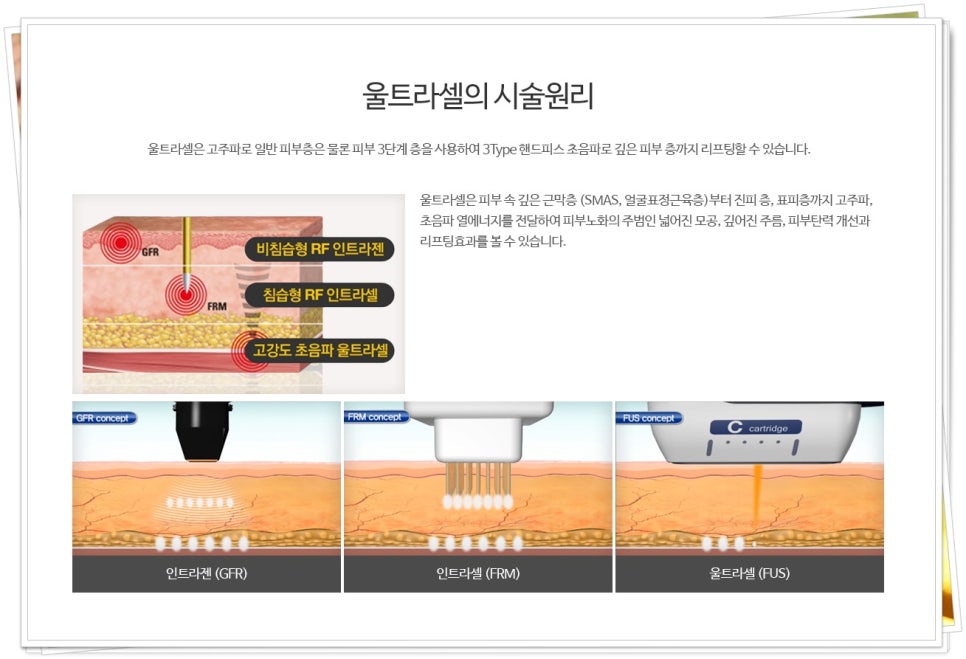 라셀 이미지