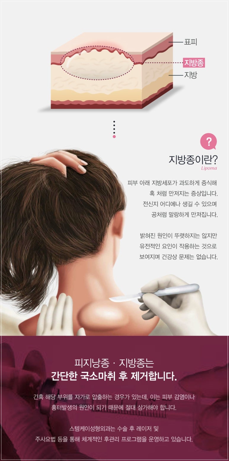 피지케이 이미지