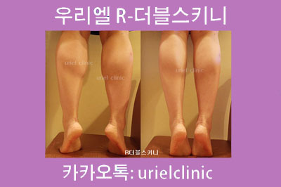 엘더블 이미지