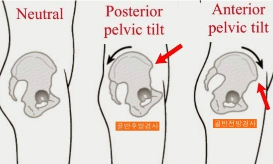 폼짐 이미지
