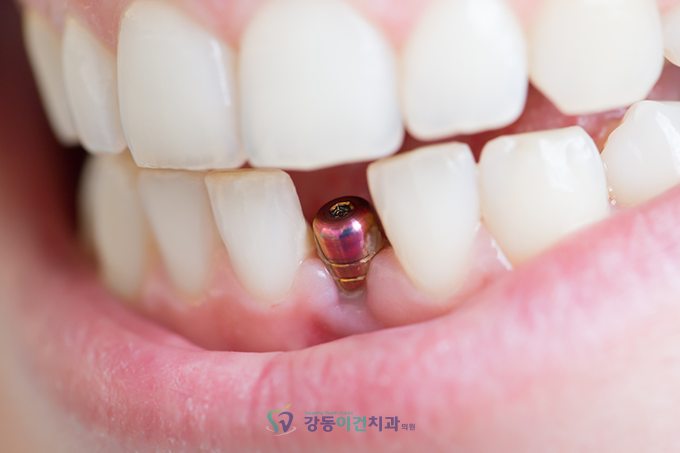 강동이건치과 이미지