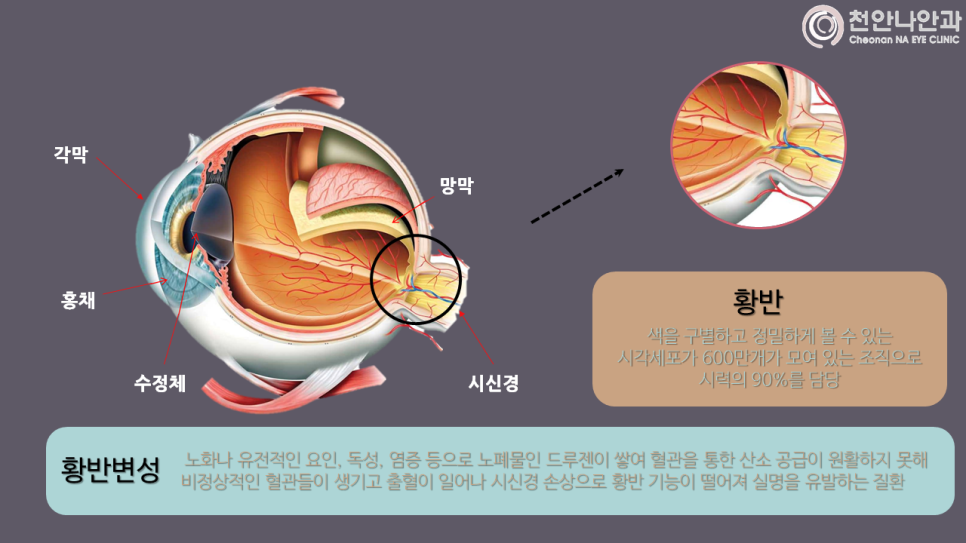 천안나안과의원 이미지