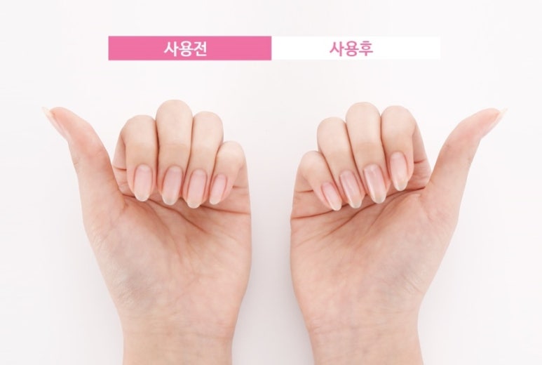 백블링네일 이미지