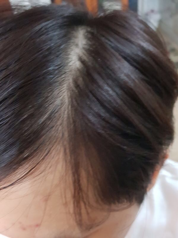 쎄다모 이미지