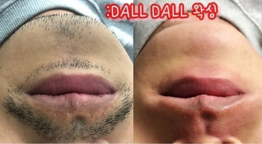 공주피부샾 이미지