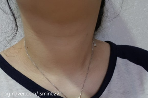 투에스엘 이미지