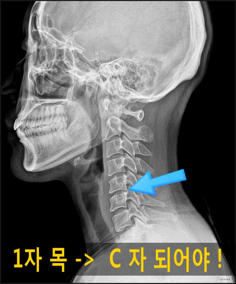 알로벳 이미지