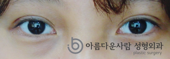 인아웃디자인 이미지