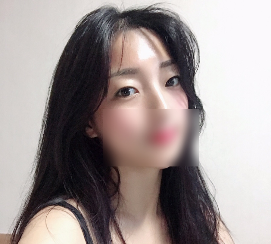 모모헤어라인 이미지