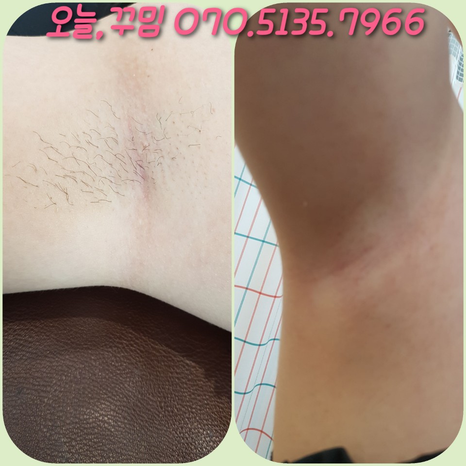 오늘;꾸밈 이미지