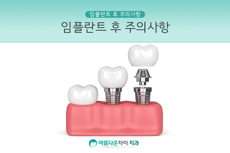 아름다운차이치과 이미지