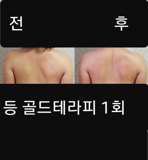 케어셀라 이미지