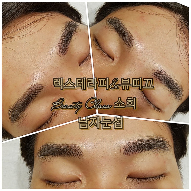 렉스테라피 이미지