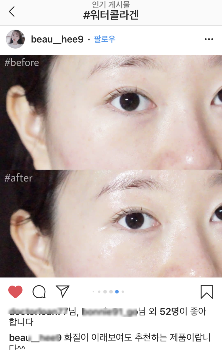 스킨메이드 이미지