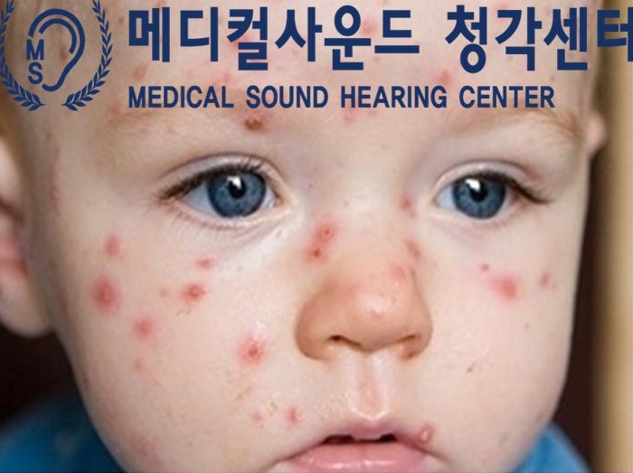 메디칼사운드 이미지