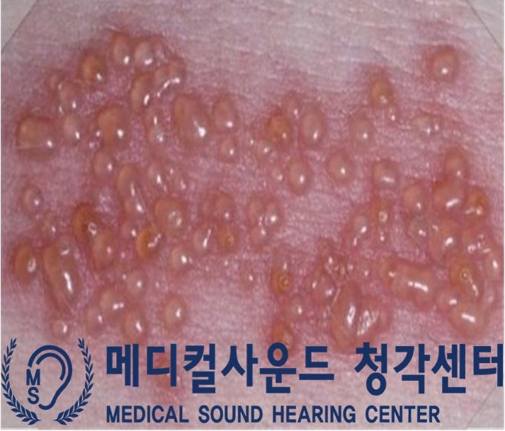 메디칼사운드 이미지
