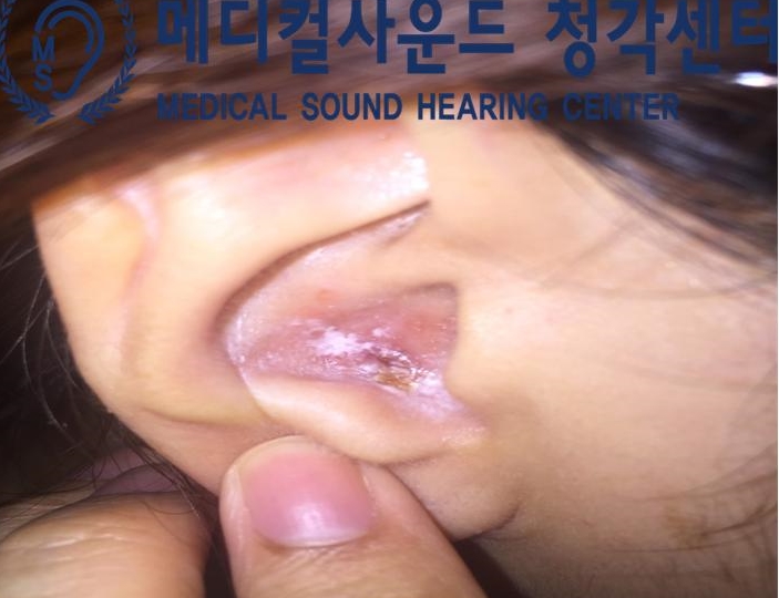 메디칼사운드 이미지