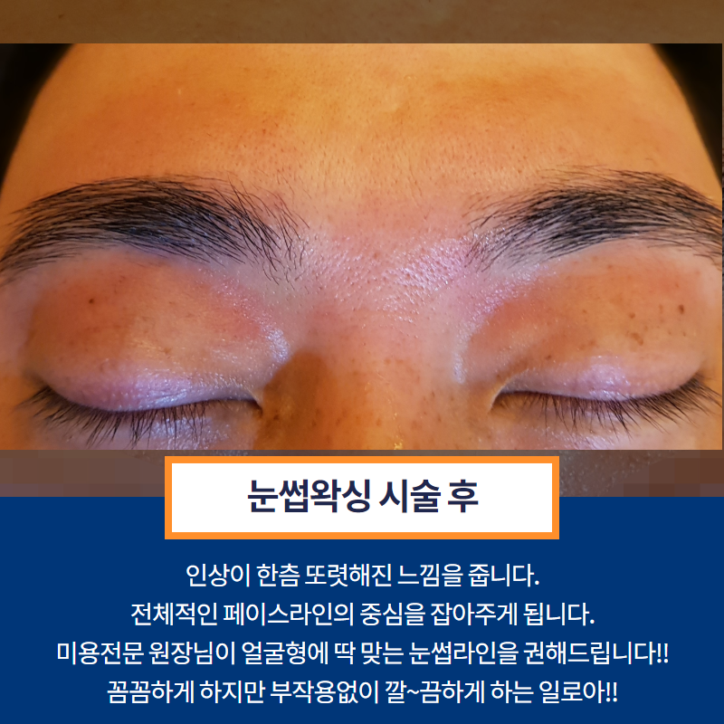 그남자왁싱 이미지