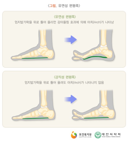 피지오스 이미지