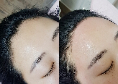필헤어라인 이미지