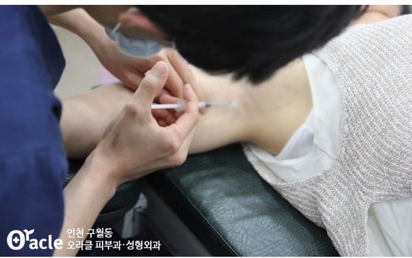 오라클피부과 이미지