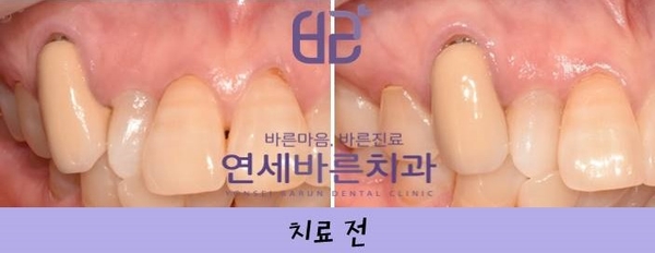 연세바른치과 이미지
