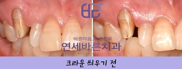 연세바른치과 이미지