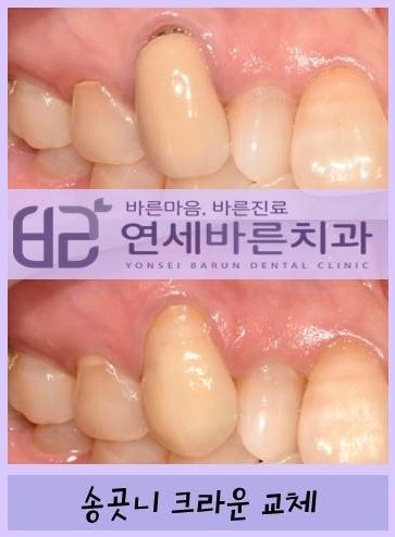 연세바른치과 이미지