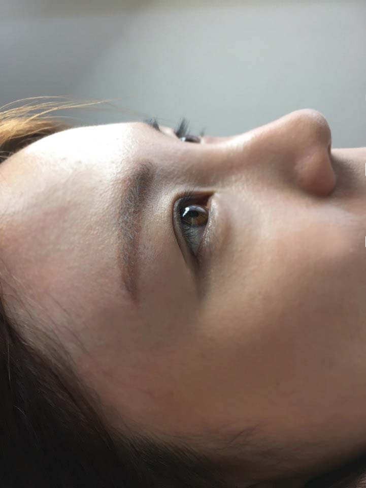 여우라인 이미지