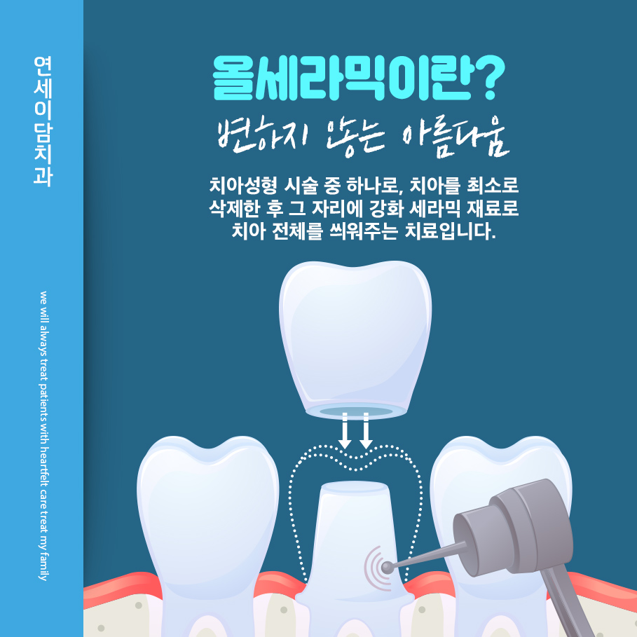 연세라믹 이미지
