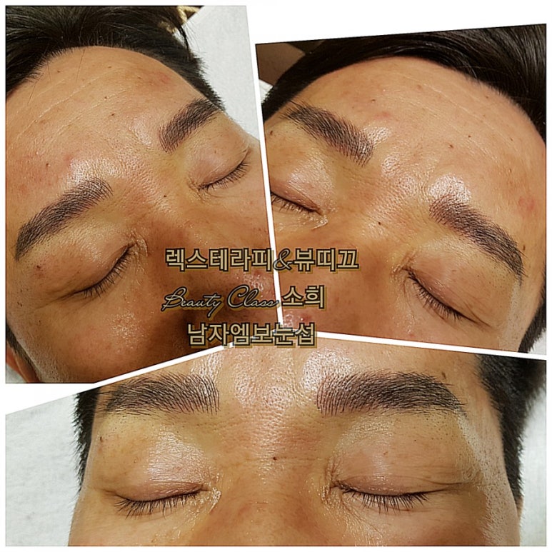 렉스테라피 이미지