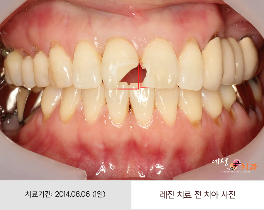 윤치과 이미지