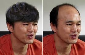 디엔헤어 이미지
