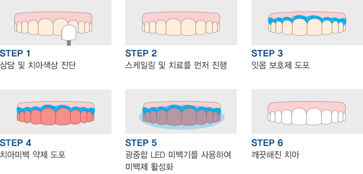 서울테라치과 이미지