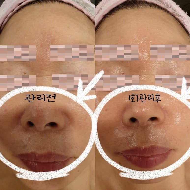 퓨어스킨앤바디 이미지