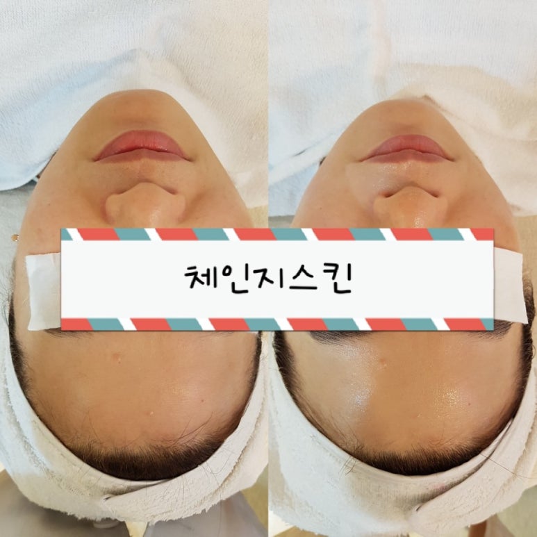 체인지스킨 이미지