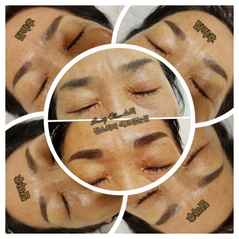 렉스테라피 이미지