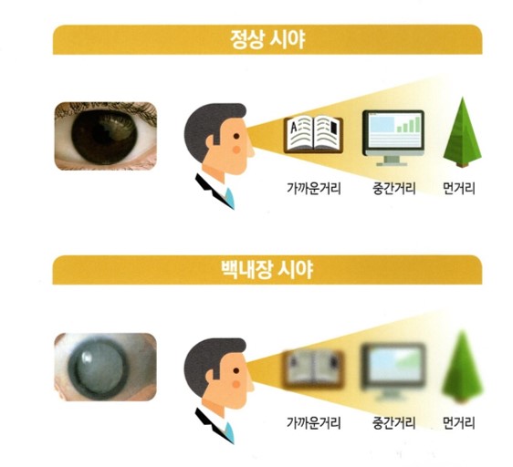 성남성모안과 이미지