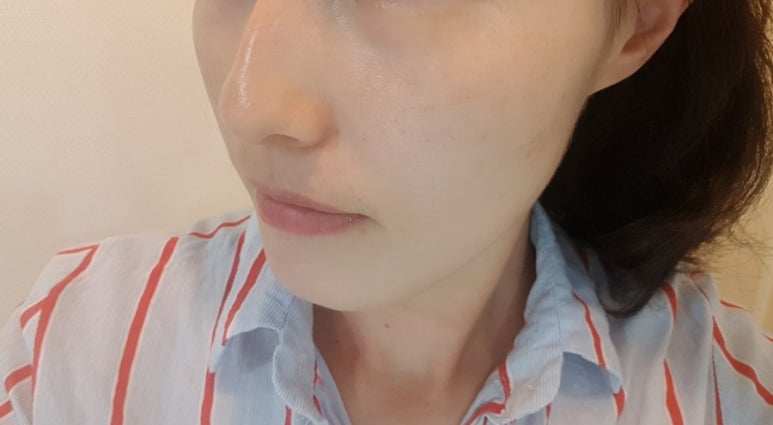 오광케어 이미지
