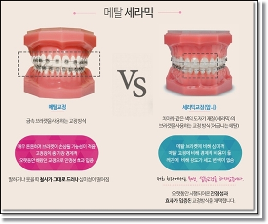 참좋은치과의원 이미지