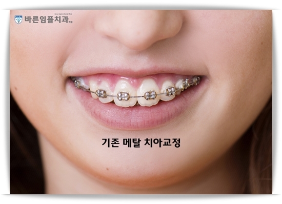 우리가족치과 이미지