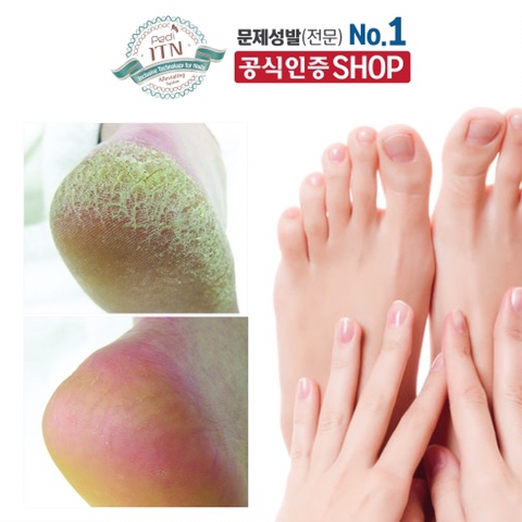 꿀네일 이미지