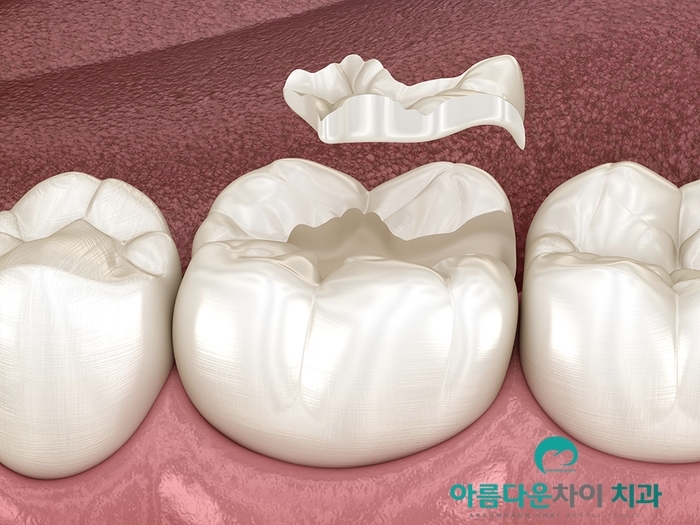 아름다운차이치과 이미지